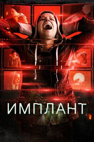 Скачать Имплант